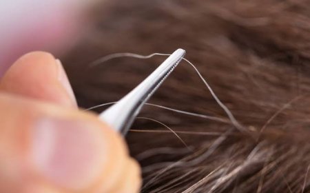 Mulai Tumbuh Uban? Simak 5 Penyebab Tumbuh Uban